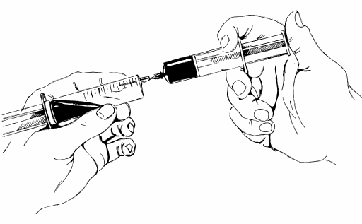 Minör Otohemoterapi