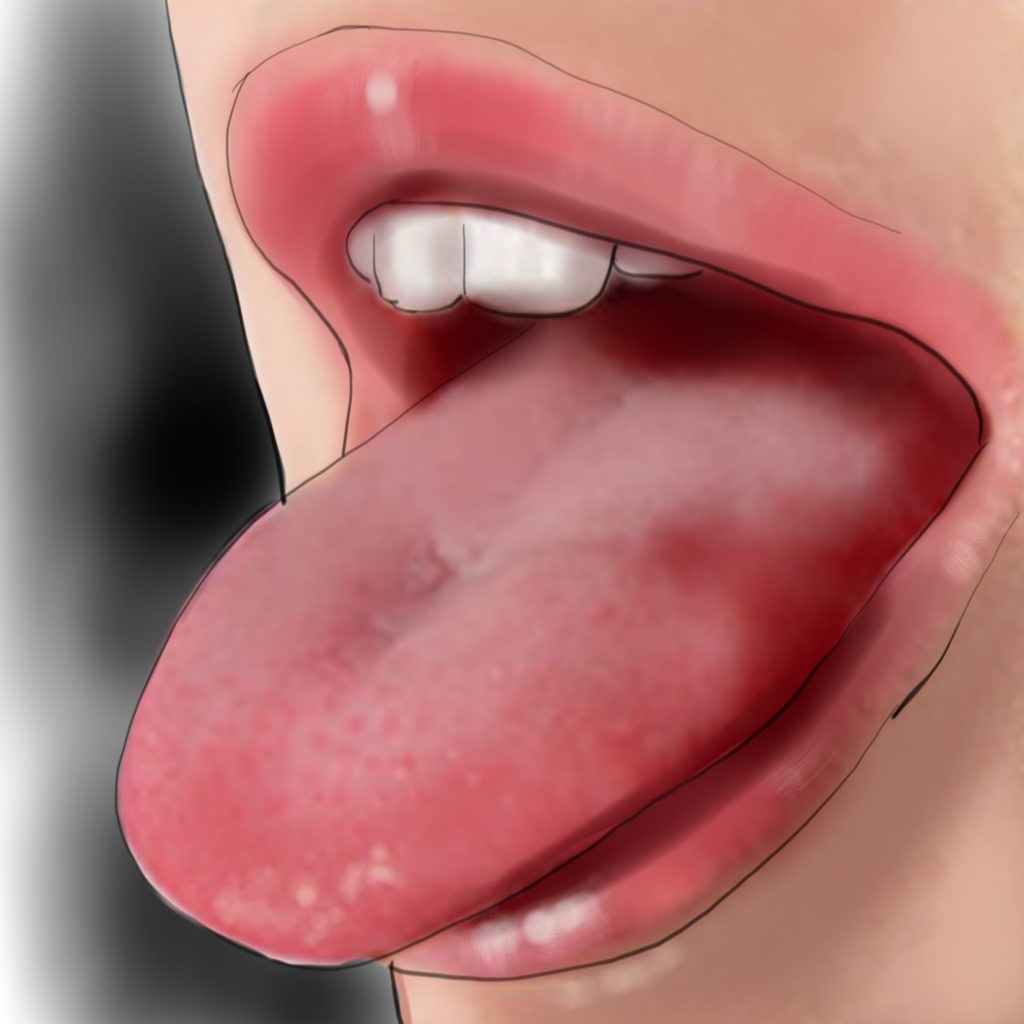 Yanan Ağız Sendromu