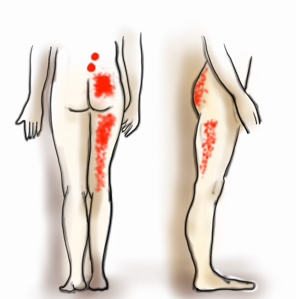 Bel Omur Eklem Ağrıları